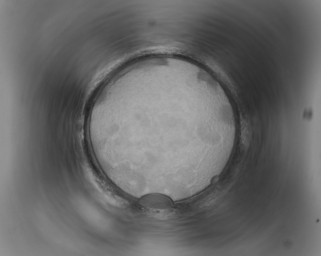 X0000114700486200911181320