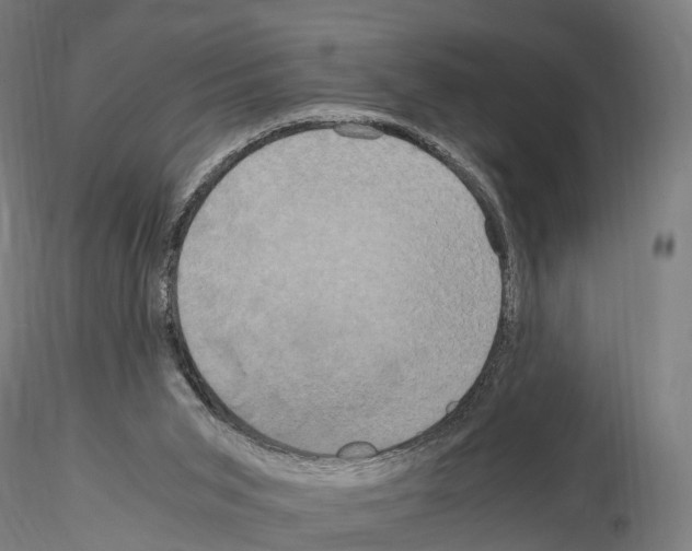 X0000114700015200912021118