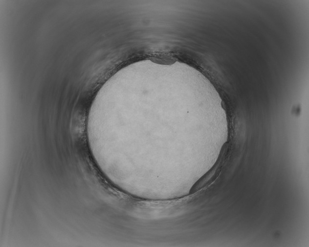 X0000114700033200912021118