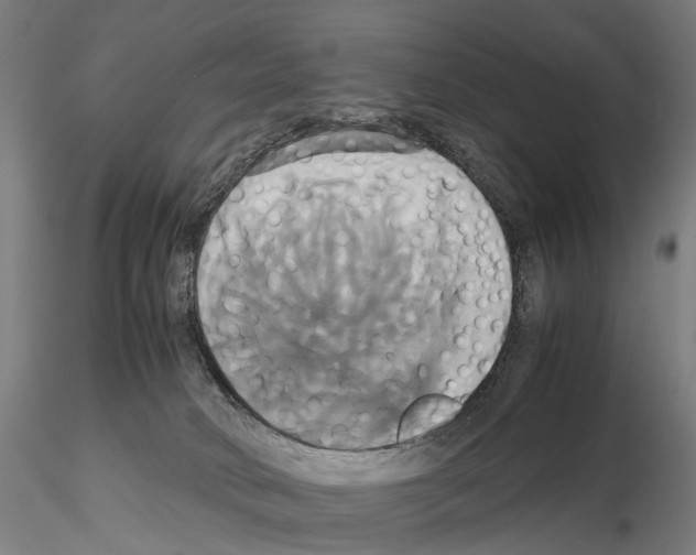 X0000114700034200912021118