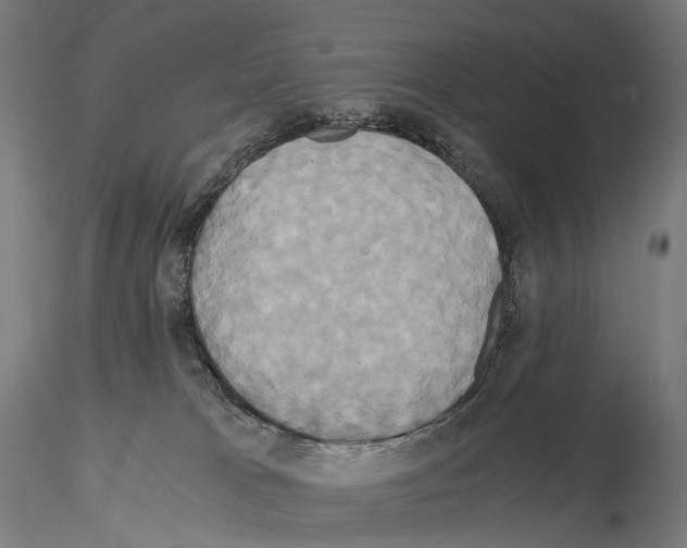 X0000114700037200912021118