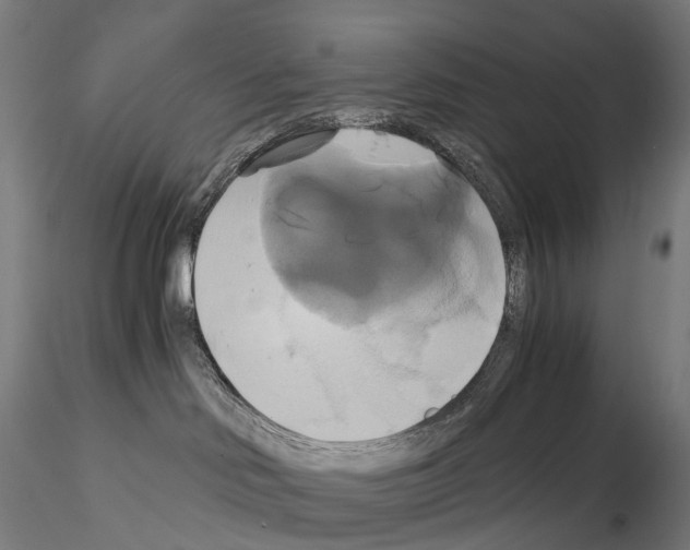 X0000114700046200912021118