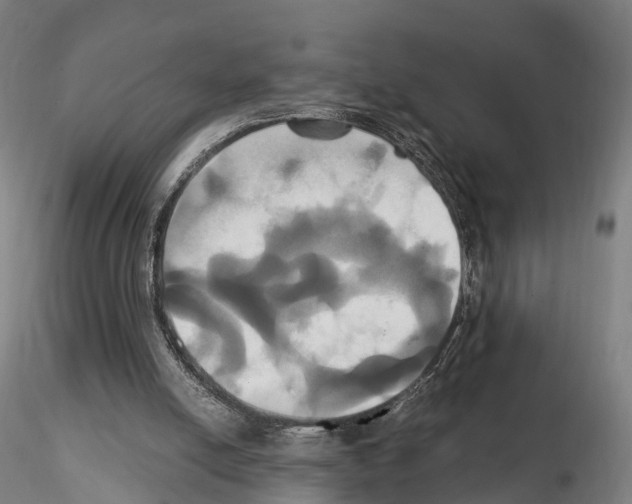 X0000114700054200912021117