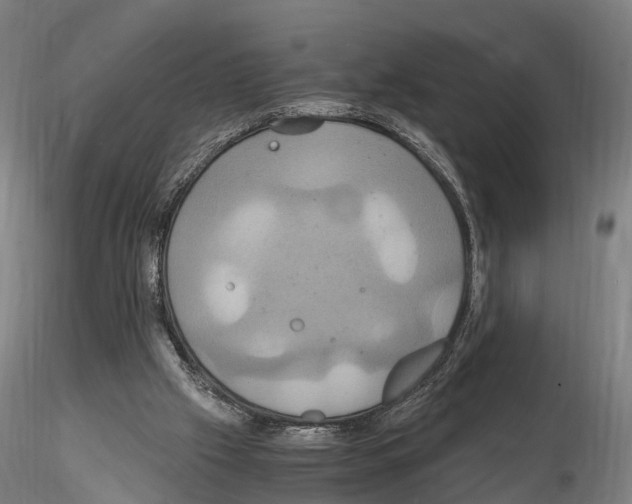 X0000114700057200912021117