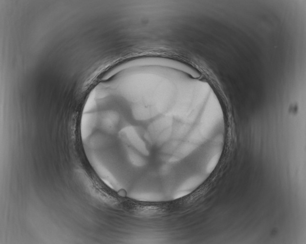 X0000114700058200912021117