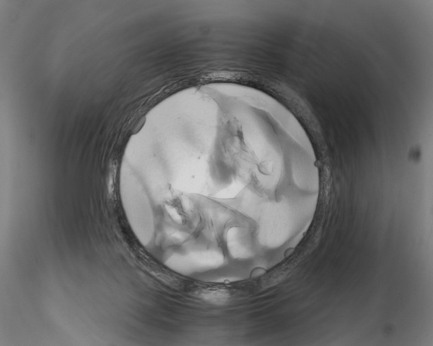 X0000114700075200912021117