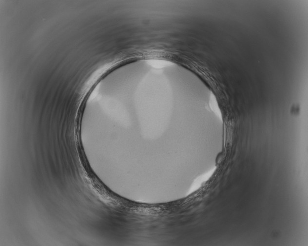 X0000114700147200912021115