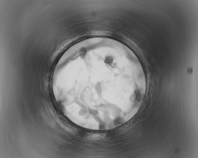 X0000114700155200912021115