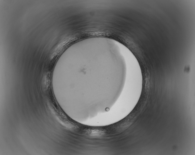 X0000114700165200912021116