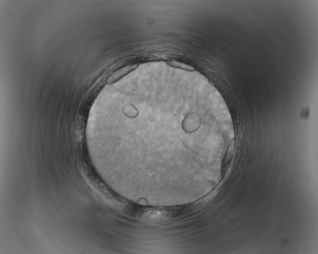 X0000114700174200912021116