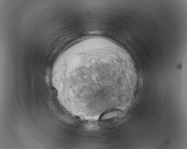 X0000114700175200912021116