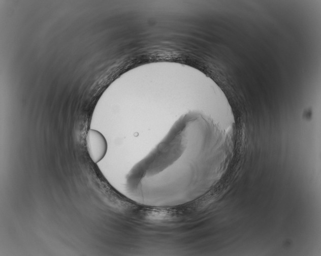 X0000114700177200912021116