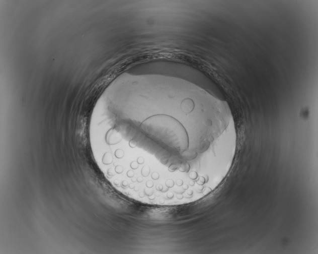 X0000114700178200912021116