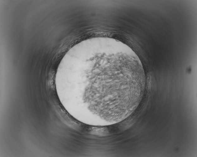 X0000114700185200912021116