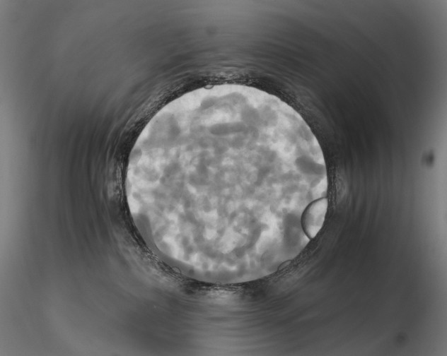 X0000114700236200912021115