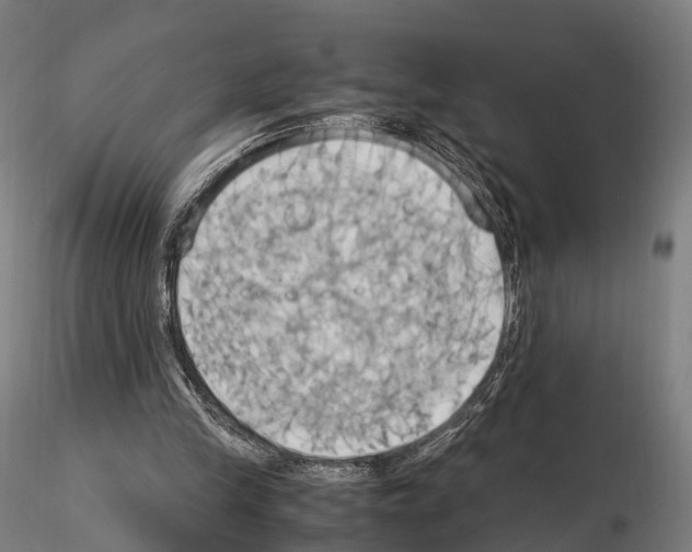 X0000114700245200912021114