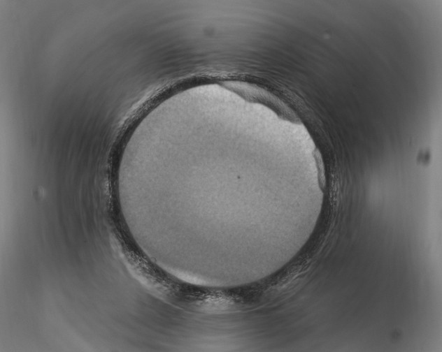 X0000114700256200912021114