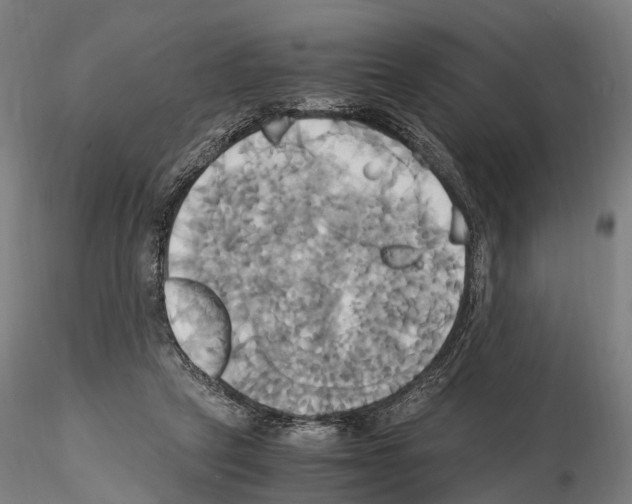 X0000114700257200912021114