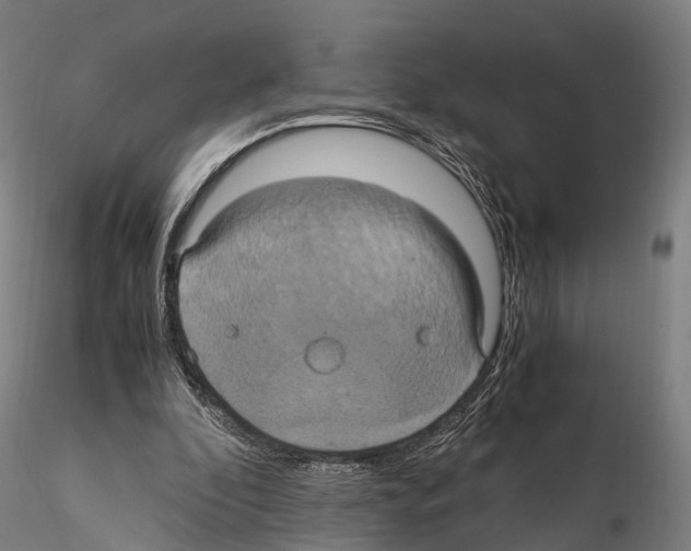 X0000114700296200912021114