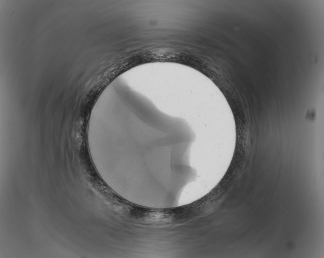 X0000114700319200912021114