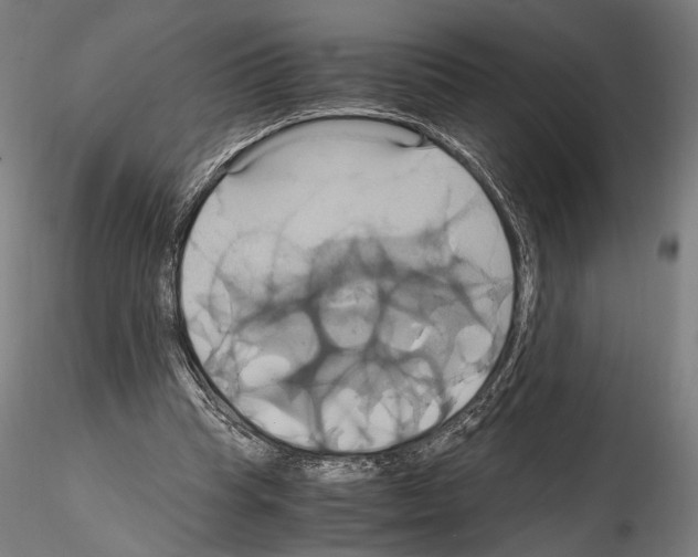 X0000114700345200912021113