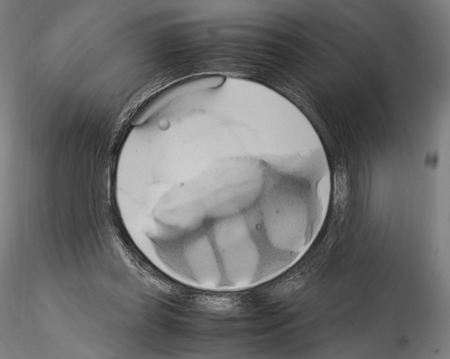 X0000114700349200912021113