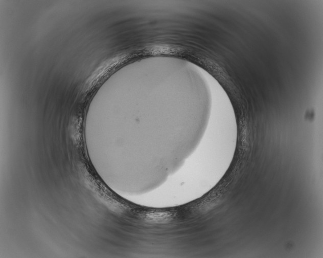 X0000114700357200912021113