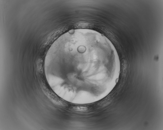 X0000114700361200912021113