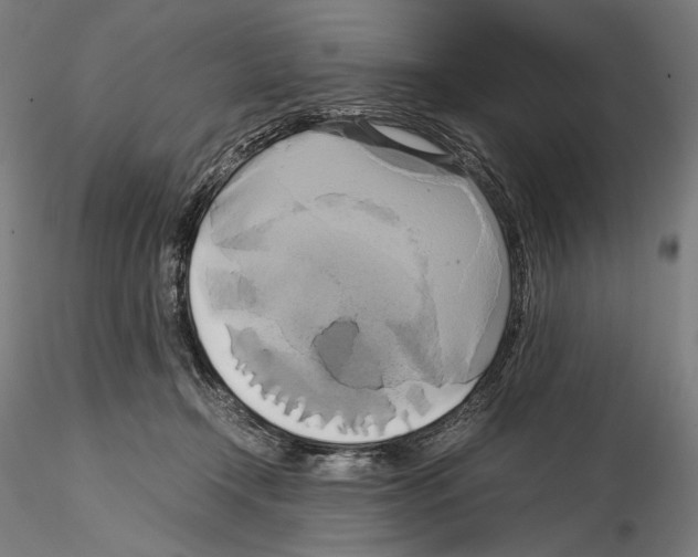 X0000114700366200912021113