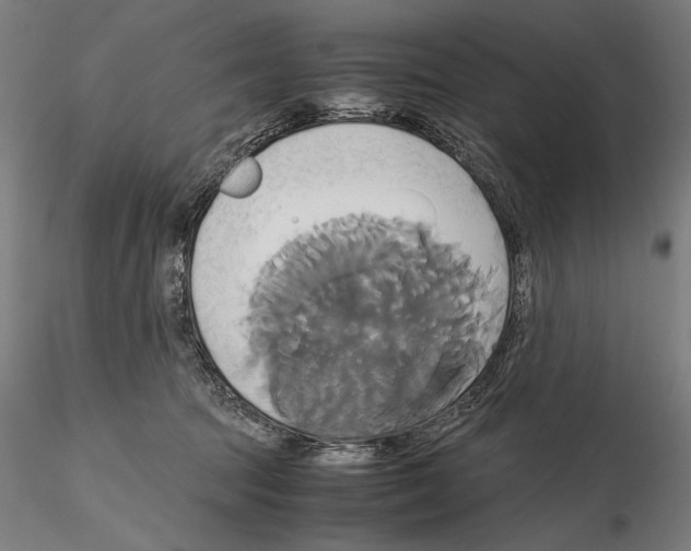 X0000114700369200912021113