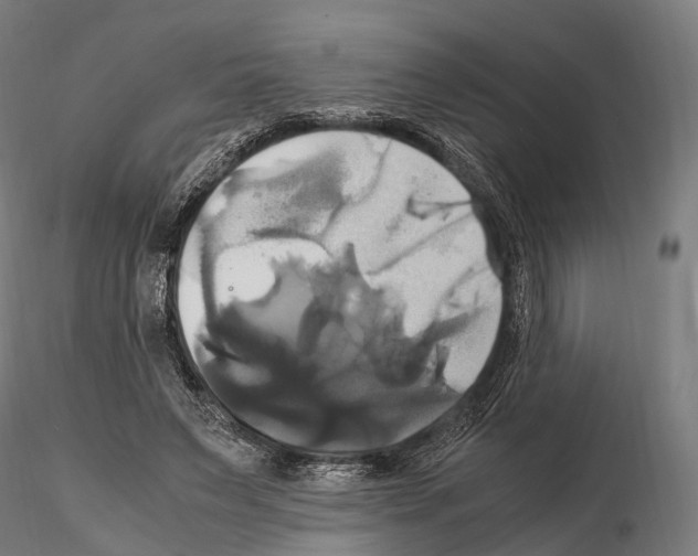 X0000114700495200912021111