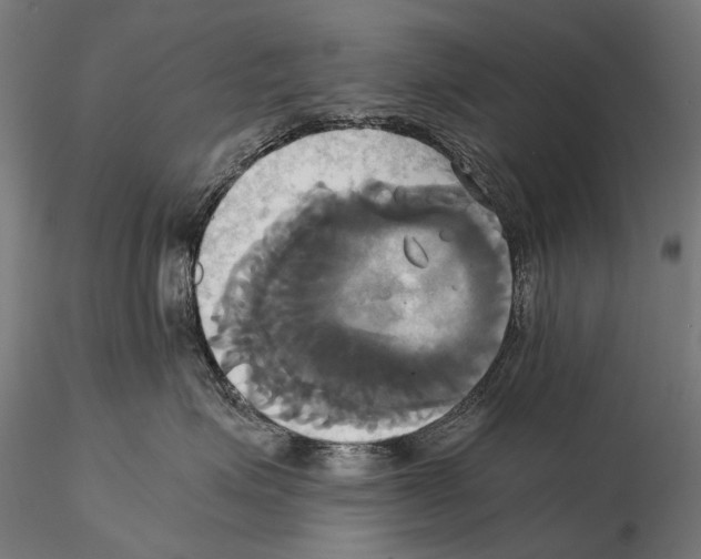 X0000114700623200912021109