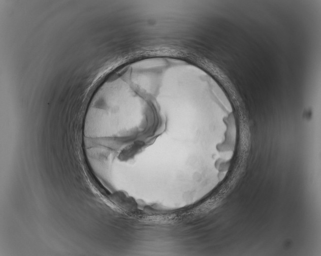 X0000114700625200912021109