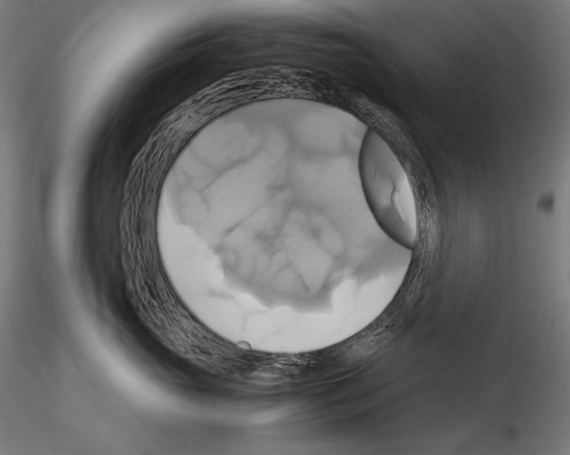 X0000114700765200912021108