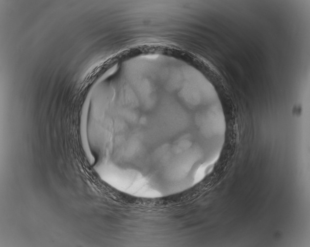 X0000114700775200912021107