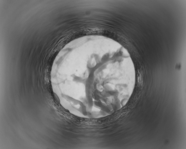 X0000114700819200912021106