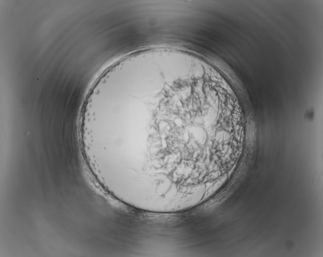 X0000114700856200912021106