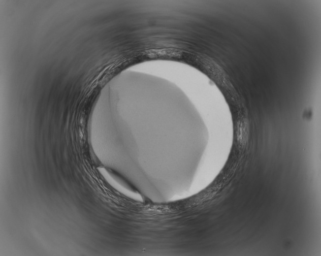 X0000114700915200912021104