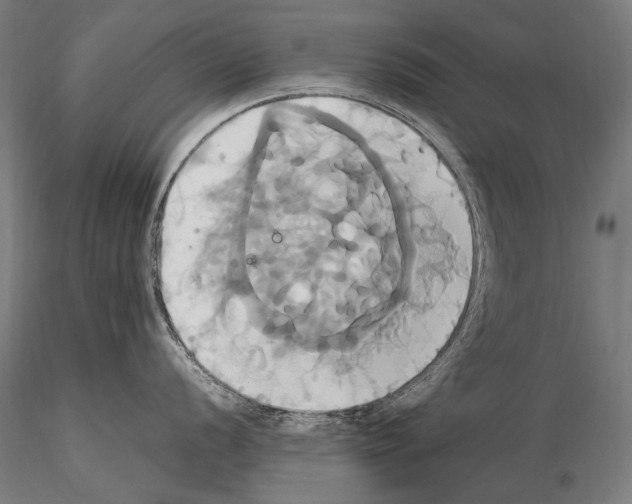 X0000114701056200912021104