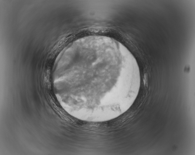 X0000114701396200912021057