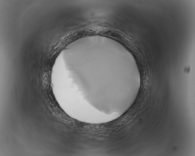 X0000114701397200912021057