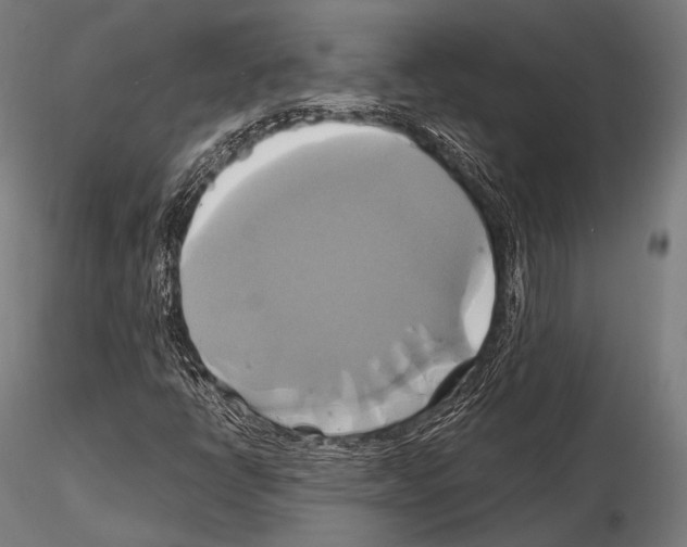 X0000114701398200912021057