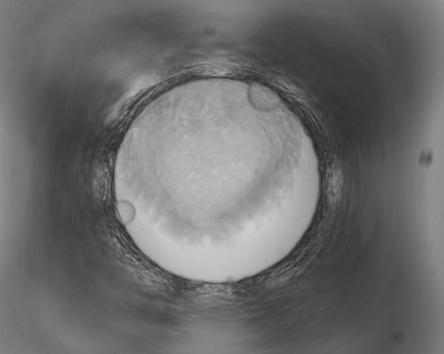 X0000114701446200912021057