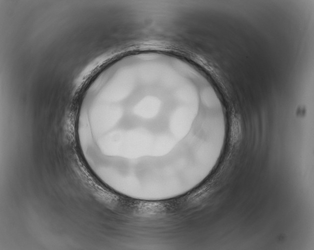 X0000114701454200912021057