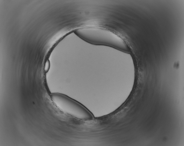 X0000114701469200912021057