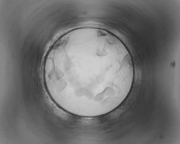 X0000114701478200912021057