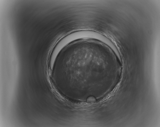 X0000114720145200910211354