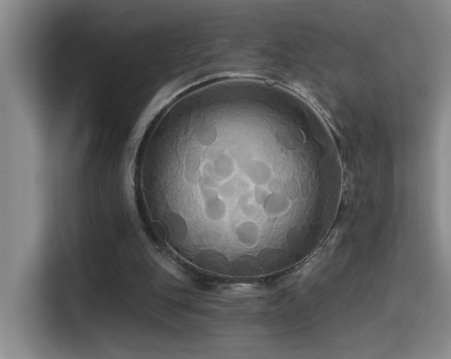 X0000114720151200910211354