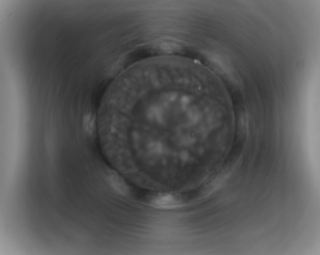 X0000114720177200910211354