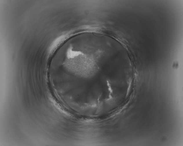 X0000114720149200911121740